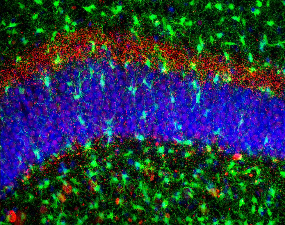 Overbooking in the Dentate Gyrus - Diego Gomez-Nicola